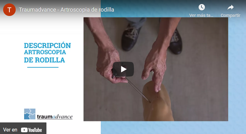 video-artroscopia-rodilla.png