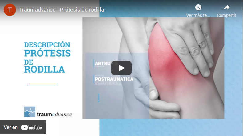 video-protesis-rodilla.png